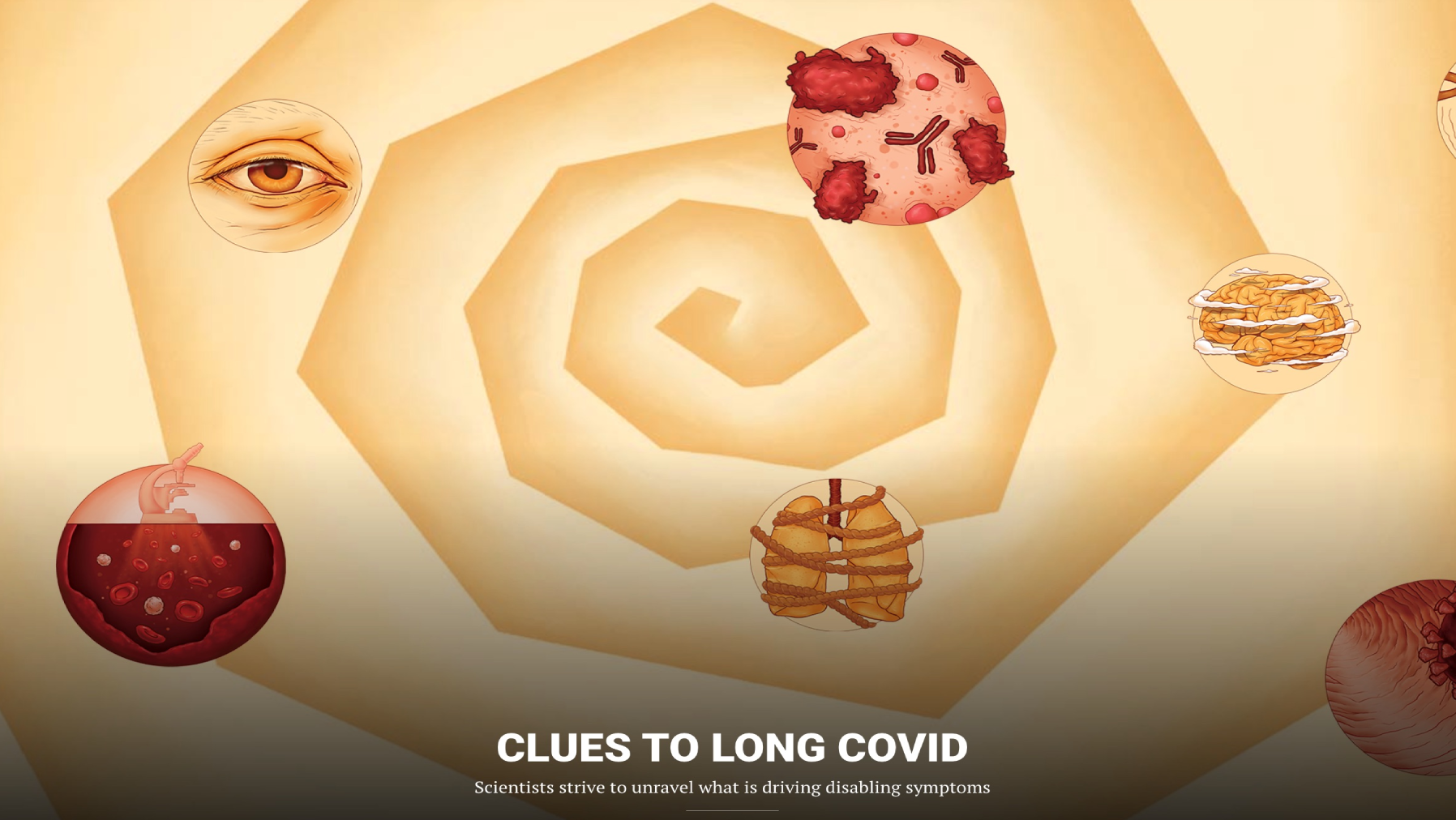 Обзорная статья “CLUES TO LONG COVID” на сайте AAAS